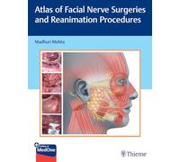 Atlas of Facial Nerve Surgeries and Reanimation Procedures