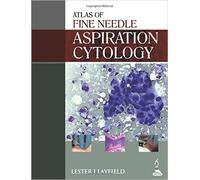 ATLAS OF FINE NEEDLE ASPIRATION CYTOLOGY
