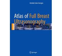 Atlas of Full Breast Ultrasonography