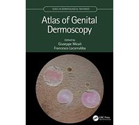 Atlas of Genital Dermoscopy (Series in Dermatological Treatment)