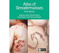Atlas of Genodermatoses