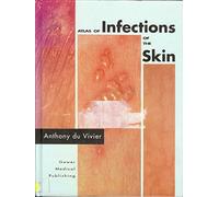 Atlas of Infections of the Skin