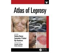 Atlas of Leprosy
