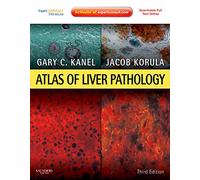 Atlas of Liver Pathology (Atlas of Surgical Pathology)