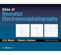 Atlas of Neonatal Electroencephalography