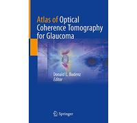Atlas of Optical Coherence Tomography for Glaucoma