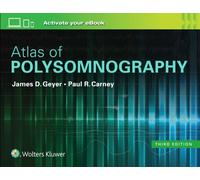Atlas of Polysomnography
