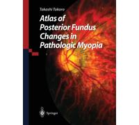 Atlas of Posterior Fundus Changes in Pathologic Myopia