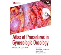 Atlas of Procedures in Gynecologic Oncology