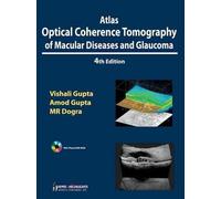 Atlas Optical Coherence Tomography of Macular Diseases and Glaucoma
