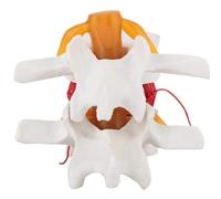 Aundhegrtt Human Anatomical Lumbar Disc Herniation Model for Teaching and Learning Life Size Spine Model
