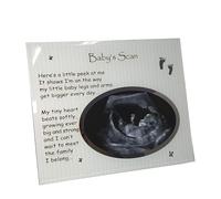 Baby Scan Keepsake Frame 19 x 23cm - Ultrasound & Baby Bump Photo Frame | Pregnancy Memory Display, New Mum Gift - One Size, One Color