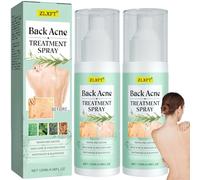 Back Pimple Solution, 2 Pieces Sprays for Body Pimples, Spray for Removing Pimples on the Back, Post Acne Treatment Sprays, Acnes Sprays Back And Chest, Body Acnes Sprayss
