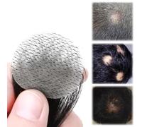 Bald Spot Hair Patch Toupee, Human Hair Natural Hair Replacement Unit For Men and women Hairline(Natural black,1.5cm)