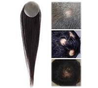 Bald Spot Hair Patch Toupee, Ultra Thin Skin V-Looped Toupee Hairline Wigs for Men and Women(black,4cm)