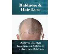 Baldness & Hair Loss: Discover Essential Treatments & Solutions To Overcome Baldness: How To Prevent Hair Loss For Guys