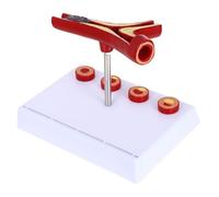 Baluue Model Cardiovascular Model Blood Vessel Anatomical Human Display for Physiology School Nursing Teaching 7.08 X 6.29 X 5.11 in
