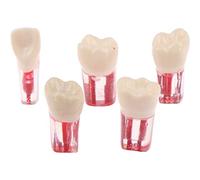 Baokuan 5pcs Resin Dental Endodontic Tooth Model Endo Root Canal Files Pulp Practice Study Endo Training Tooth Rct Demo Student Teaching