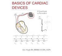 Basics of Cardiac Devices: A Visual Guide on Pacemakers