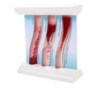 BAZEITFLOW Dynamic Blood Vessel Model Plastic Vascular Model for Teaching Using PP and Acrylic Demonstrating Health to Illness with Easy-to-operate Design in Doctor's Office and Classroom