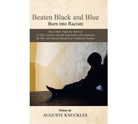 Beaten Black and Blue : Born into Racism