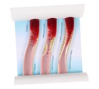 Beaupretty Dynamic Human Blood Vessel Model Anatomical Teaching Tool for Medical Students Doctors Instructors with Low-density Lipoprotein Simulation and Plaque Visualization
