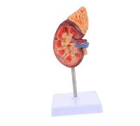 Beaupretty Human Kidney Anatomy Model with Detachable Organs Stand Realistic Biology Demonstration Tool for Medical School Patient Education and High School Teaching Aid