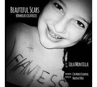 Beautiful Scars | Hermosas Cicatrices