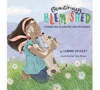 Beautifully Blemished: Learning and Celebrating Skin Differences