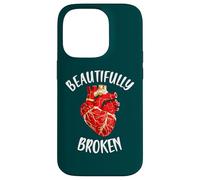 Beautifully Broken Japanese Pottery Kintsugi Art Case for iPhone 14 Pro