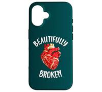 Beautifully Broken Japanese Pottery Kintsugi Art Case for iPhone 16