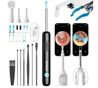 BEBIRD Ear Wax Removal Tool with HD Camera - R1 Upgraded Smart Visual Ear Cleaner with Otoscope, Ear Viewer with 6 LED Light & Multi Replacement Tips for Cleaning Earwax & Inspection Kits