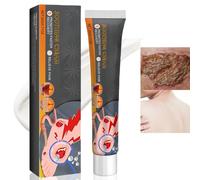 Bed Sore Cream,Bed Sore Wound Treatment Cream,Bedsore Wound Care,Pressure Sore Cream,Coldsore Treatment,Barrier Cream for Bed Sores,Effective Wound Cream,Soothing Relief for Bed Soress,Cold Sore Cream