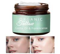 Beef Tallow Castor Oil Frankincense Balm,Grass-fed Beef Tallow Skin Care, Beef Tallow Shea Butter Raw Face Butter,Body Cream For All Skin Types-141ml