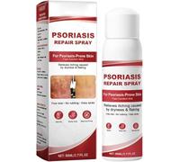 Beef Tallow Spray,Psoriasis Relief Spray,Gentle Soothing And Moisturizing Sprays,For All Skin Types