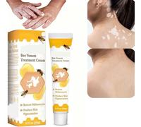 Beevenom Vitiligo Treatment Cream, Vitiligo Treatment Cream, Bee Venom Treatment for Vitiligo, Bee Venom Vitiligo Cream, Beevenom Vitiligo Treatment Cream for All Skin Types (1 Piece)