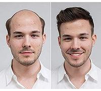 BeiLuo Natural Hairline Toupee 100% Human European Hair System 8x9 Inch Hair Replacement System for Men