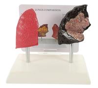 BELLIFFY Human Lung Anatomy Model PVC Material Smoking and Healthy Lung Comparison Teaching Aid for Physiology and Medical Education Schools