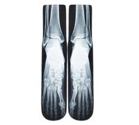 Benefeet Sox Men Funny Novelty Crazy Crew Tube Socks Unisex 3D Print Dress Sock Boy Colorful Patterned Design Calf Sock, X-ray Bone, Medium
