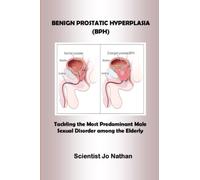 BENIGN PROSTATIC HYPERPLASIA: Tackling the Most Predominant Male Sexual Disorder among the Elderly