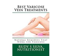 Best Varicose Vein Treatments: Natural Remedies That Work For Varicose
