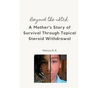Beyond the Itch: A Mother's Story of Survival Through Topical Steroid Withdrawal