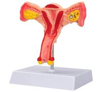 Bilateral Ovarian Uterus Structure Model, Female Pelvic Reproductive Cross Section Anatomical Model, for Classroom Display and Gynecological Teaching Tool