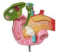 Biliary and Pancreatic Duodenal Model - Duodenal Model - Gallbladder Pathology Digestive System Model Scientific Teaching Tool Toy Models Educational Materials