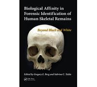 Biological Affinity in Forensic Identification of Human Skeletal Remains: Beyond Black and White