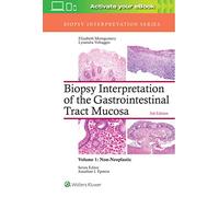 Biopsy Interpretation of the Gastrointestinal Tract Mucosa: Volume 1: Non-Neoplastic (Biopsy Interpretation Series)