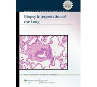 Biopsy Interpretation of the Lung (Biopsy Interpretation Series)
