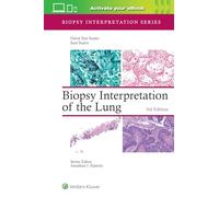 Biopsy Interpretation of the Lung: Print + ebook with Multimedia (Biopsy Interpretation Series)