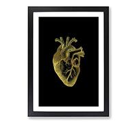 Black Gold Anatomical Heart Framed Print | A2 Black Framed Wall Art | Ready to Hang | Modern Nature Picture | Living Room Bedroom Lounge Office