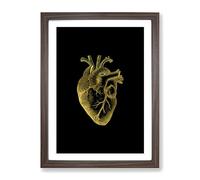 Black Gold Anatomical Heart Modern Framed Wall Art Print, Ready to Hang Picture for Living Room Bedroom Home Office Décor, Walnut A3 (34 x 46 cm)